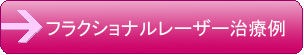 tNVi[U[×