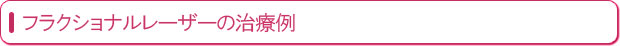 tNVi[U[̎×